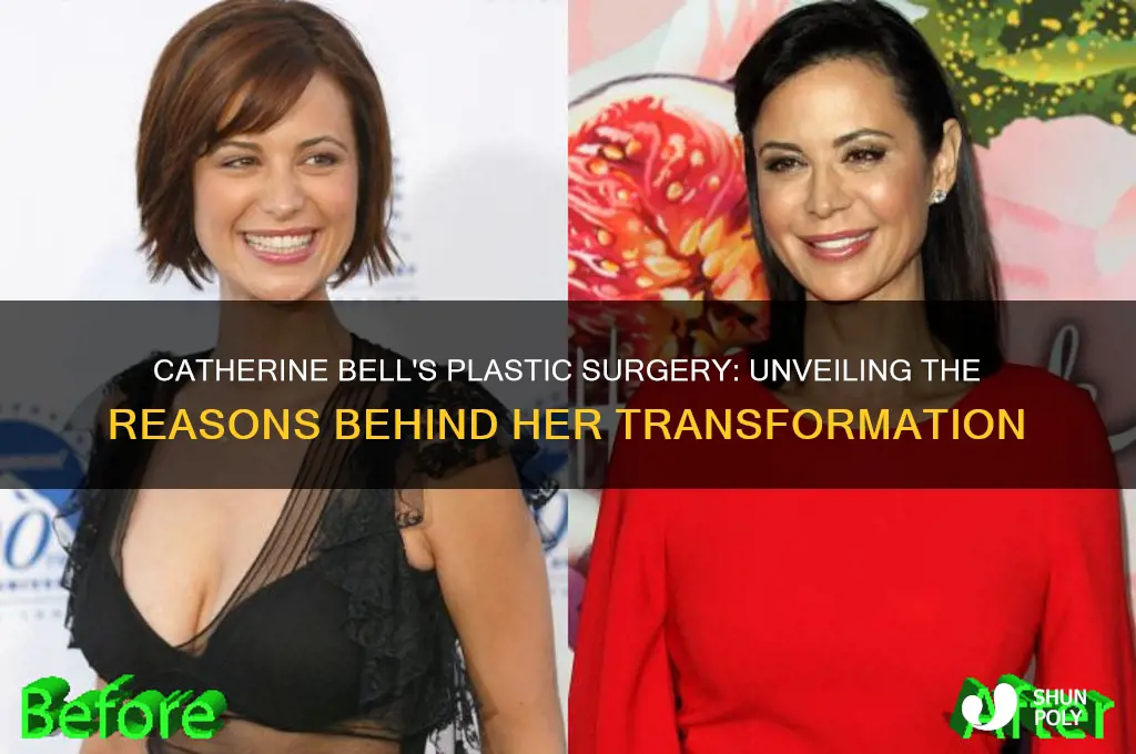 why did catherine bell have plastic surgery