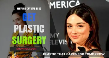 Crystal Reed's Plastic Surgery: Unveiling the Reasons Behind Her Transformation