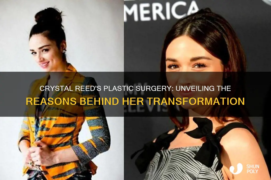 why did crystal reed get plastic surgery