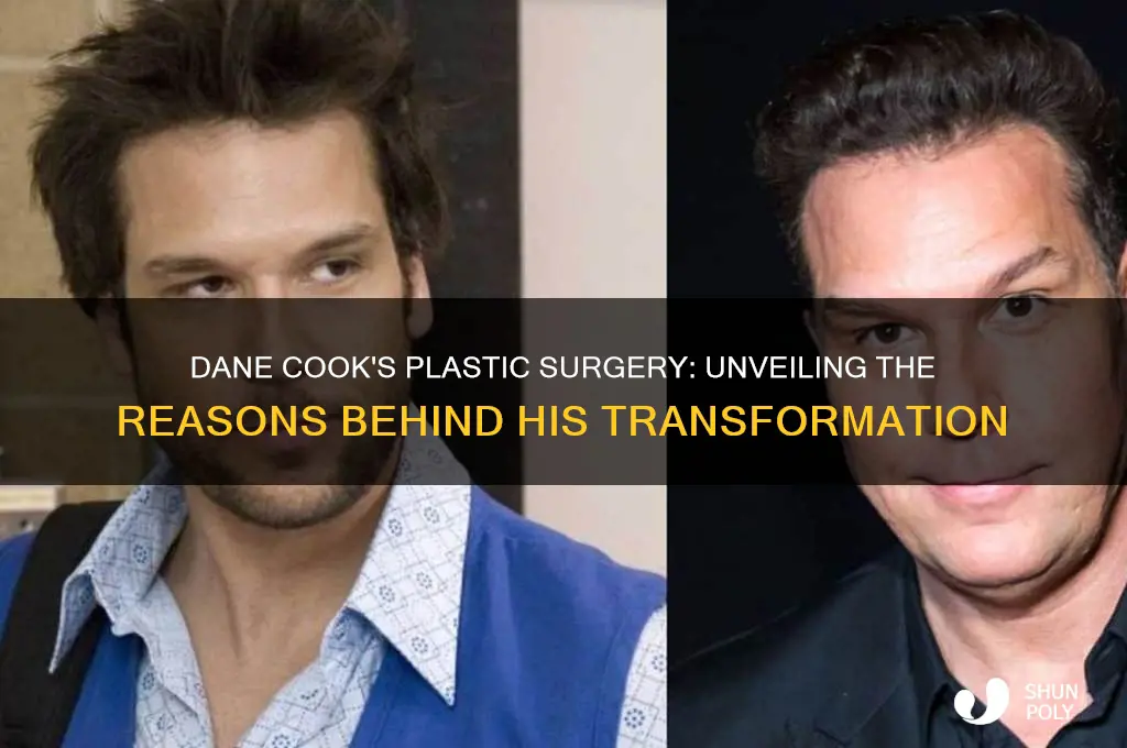why did dane cook get plastic surgery
