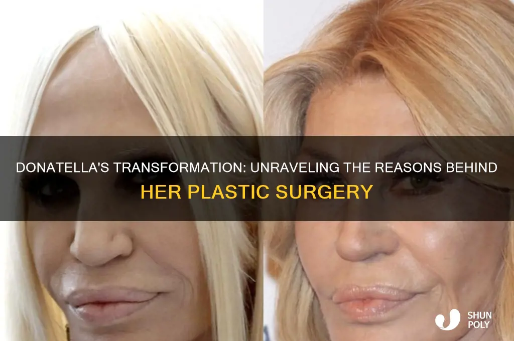 why did donatella get plastic surgery