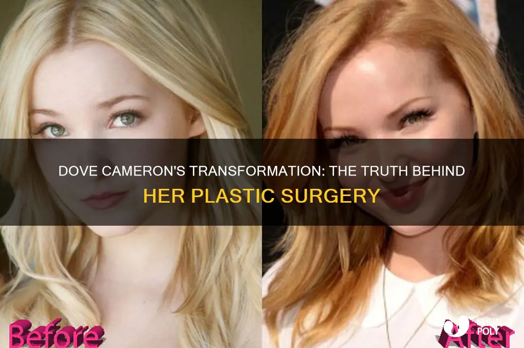 why did dove cameron get plastic surgery