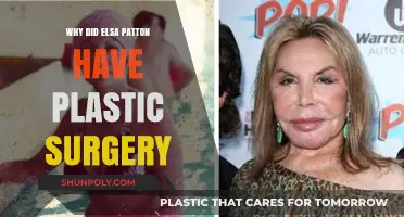 Elsa Patton's Plastic Surgery: Unraveling the Reasons Behind Her Transformation