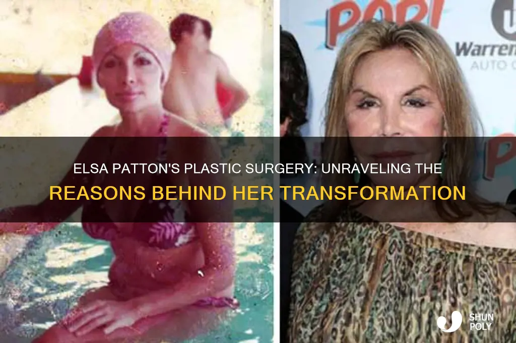 why did elsa patton have plastic surgery