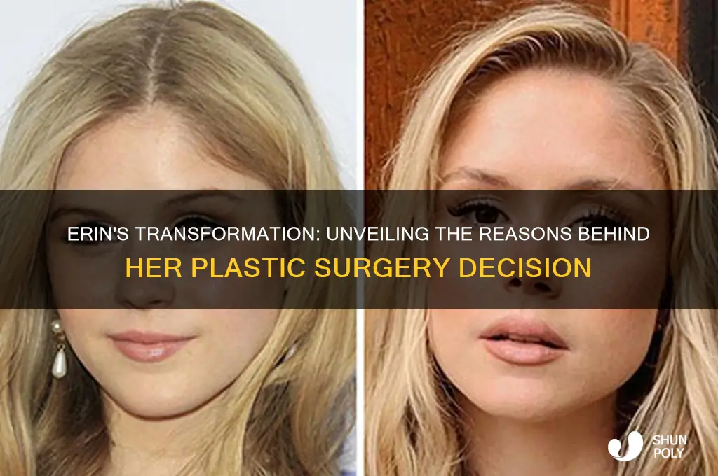 why did erin get plastic surgery