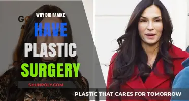 Famke's Transformation: Unveiling the Reasons Behind Her Plastic Surgery