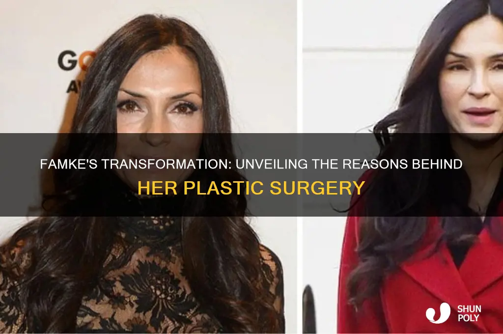 why did famke have plastic surgery