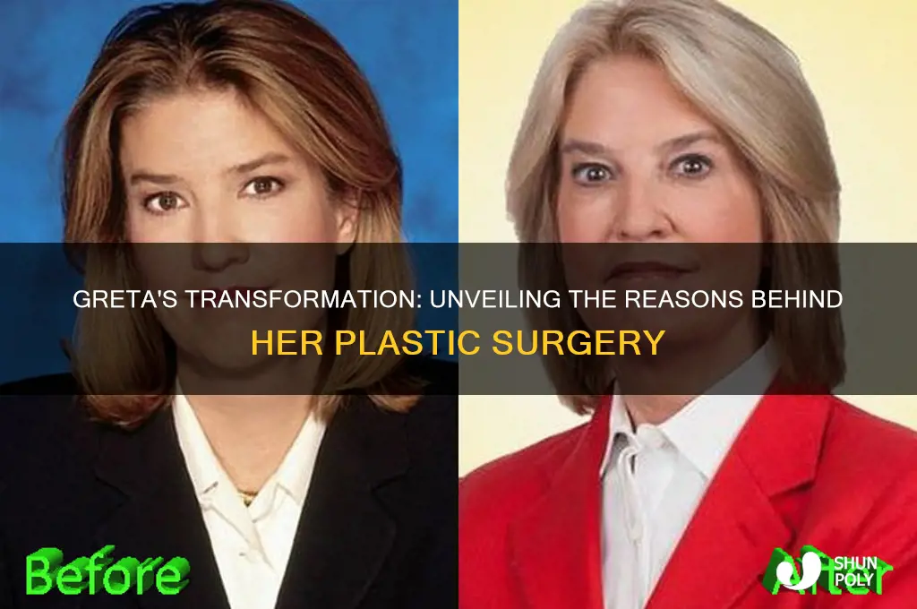 why did greta have plastic surgery