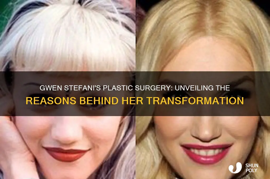 why did gwen stefani get plastic surgery