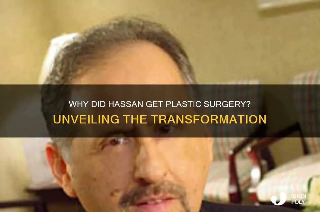 why did hassan get plastic surgery