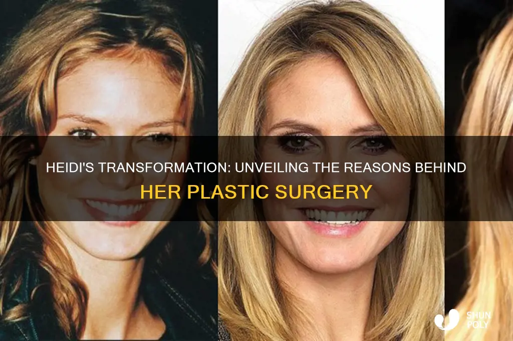 why did heidi get plastic surgery