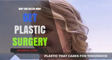 Helen Hunt's Plastic Surgery: Unraveling the Reasons Behind Her Transformation