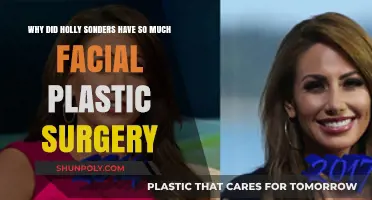 Holly Sonders' Dramatic Transformation: Uncovering Her Facial Surgery Choices