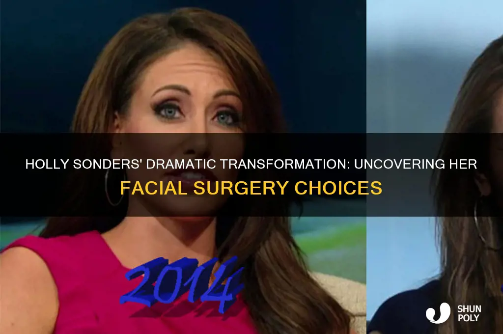why did holly sonders have so much facial plastic surgery