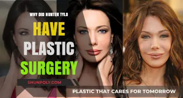 Hunter Tylo's Plastic Surgery: Unveiling the Reasons Behind Her Transformation