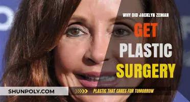 Jacklyn Zeman's Plastic Surgery: Unveiling the Reasons Behind Her Transformation