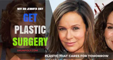 Jennifer Grey's Plastic Surgery: Unraveling the Reasons Behind Her Transformation
