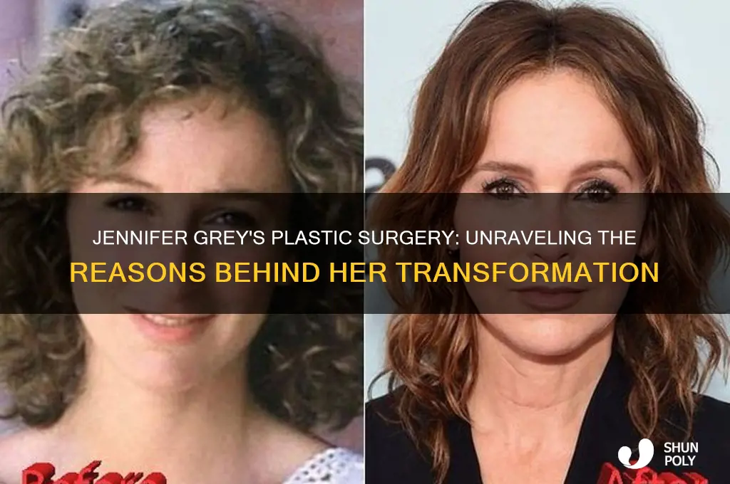 why did jennifer grey get plastic surgery