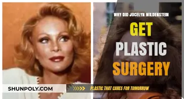 Jocelyn Wildenstein's Plastic Surgery: Unraveling the Reasons Behind Her Transformation