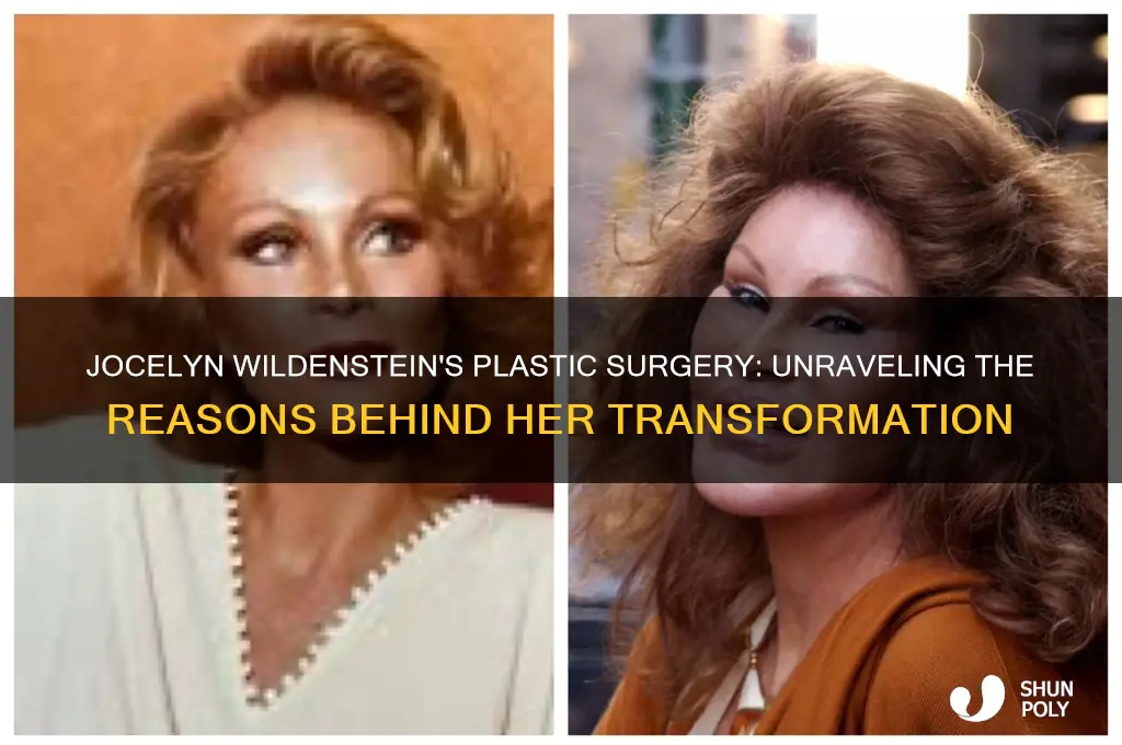 why did jocelyn wildenstein get plastic surgery