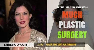 Lara Flynn Boyle's Dramatic Transformation: The Plastic Surgery Journey Explored
