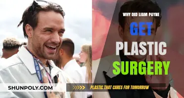 Liam Payne's Plastic Surgery: Unveiling the Reasons Behind His Transformation