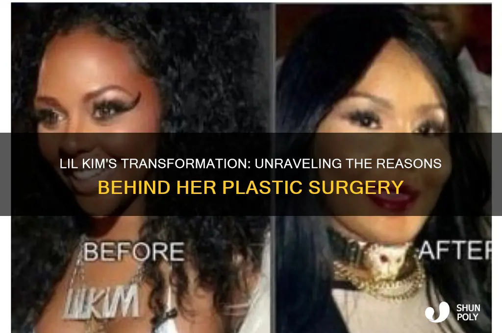 why did lil kim get plastic surgery