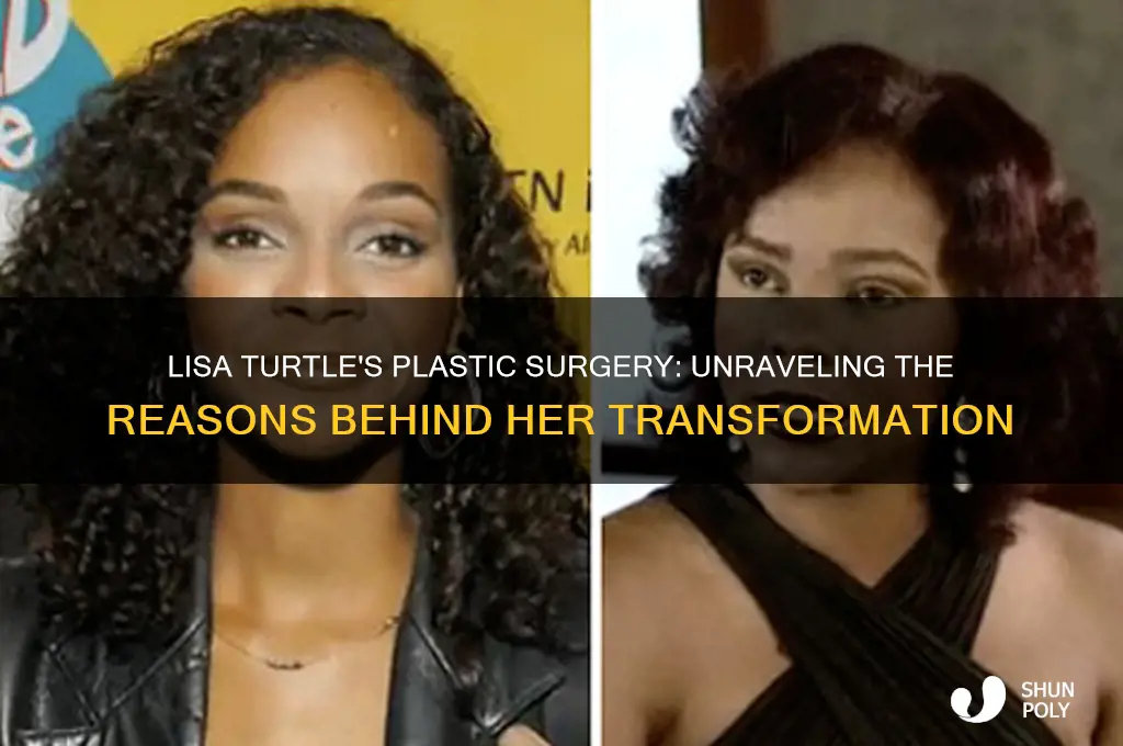 why did lisa turtle get plastic surgery