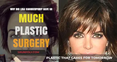 Lisa Vanderpump's Plastic Surgery Journey: Unveiling Her Transformation