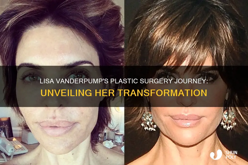 why did lisa vannderpump have so much plastic surgery