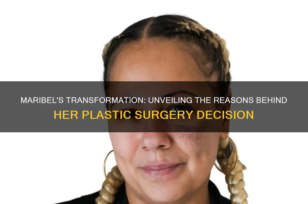 why did maribel get plastic surgery
