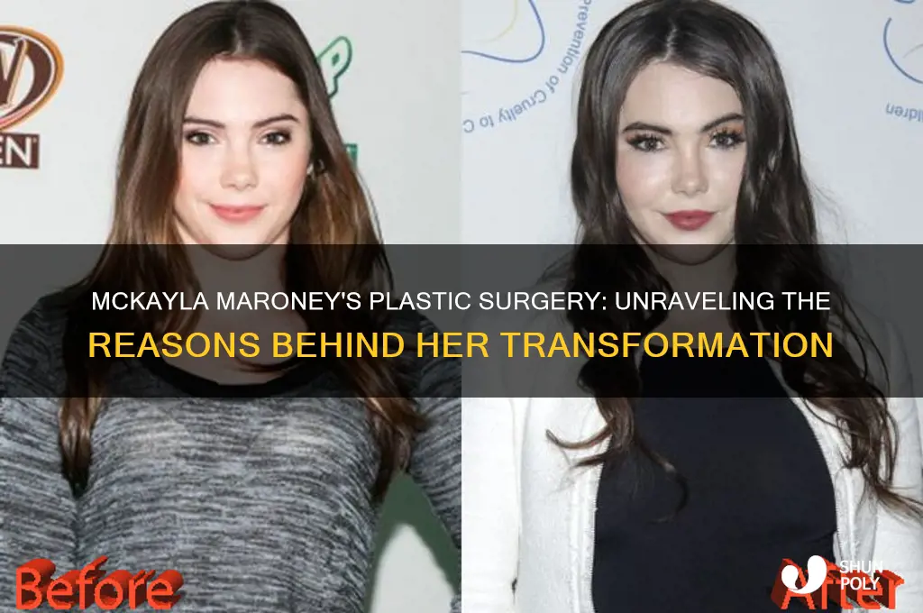 why did mckayla maroney get plastic surgery