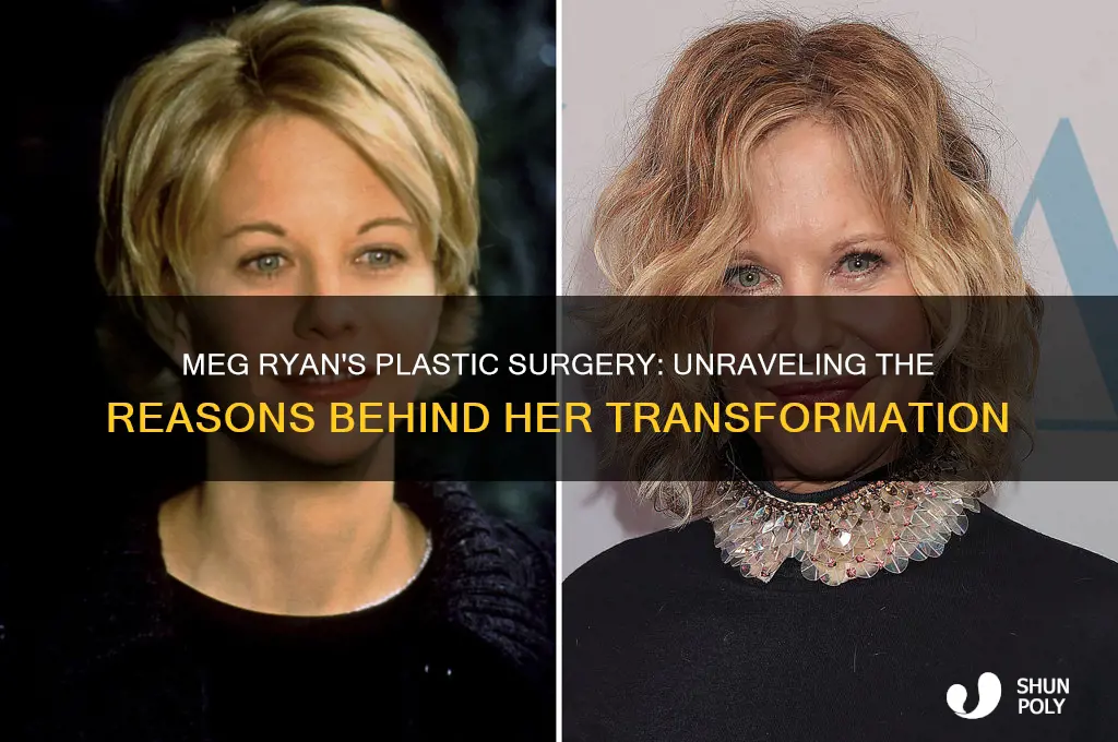 why did meg ryan get plastic surgery