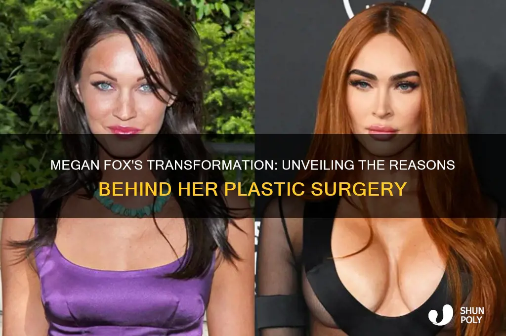 why did megan fox get plastic surgery