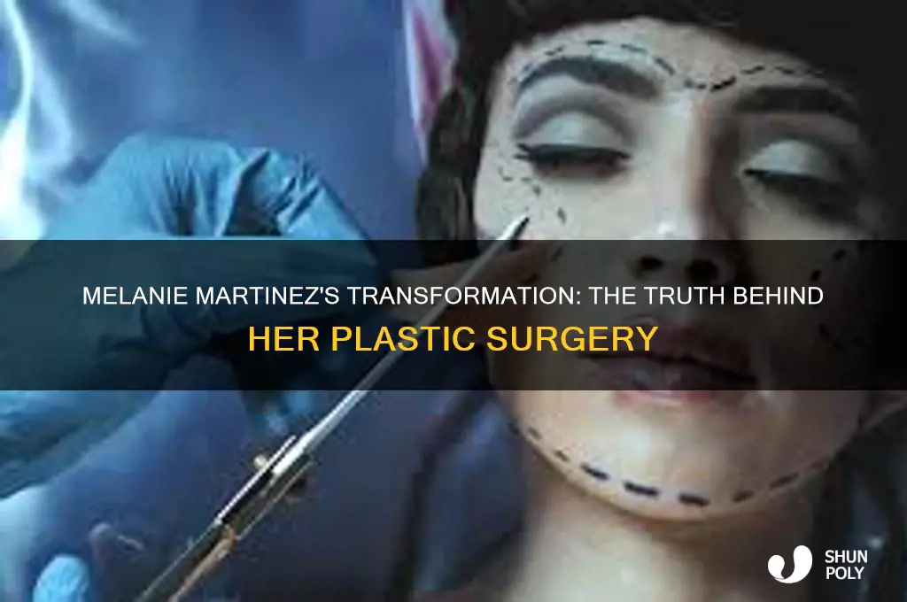 why did melanie martinez get plastic surgery