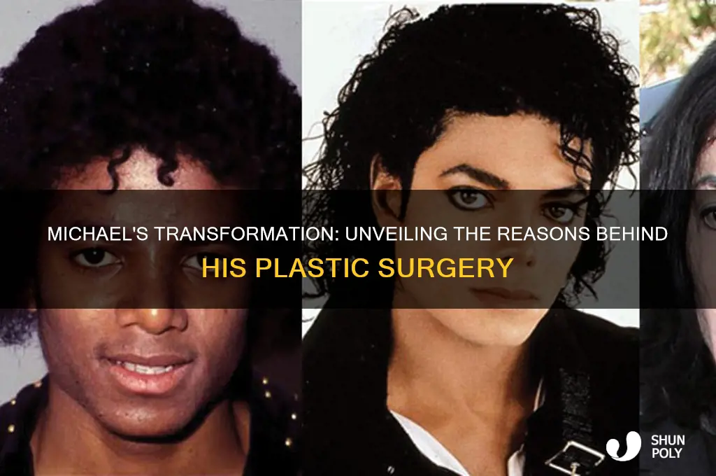 why did michael get plastic surgery