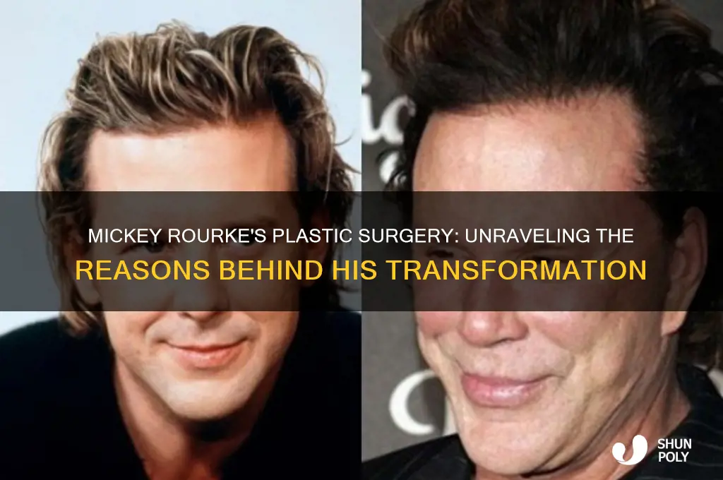 why did mickey roarke get plastic surgery