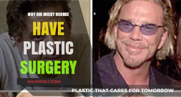 Micky Rourke's Plastic Surgery: Unraveling the Reasons Behind His Transformation
