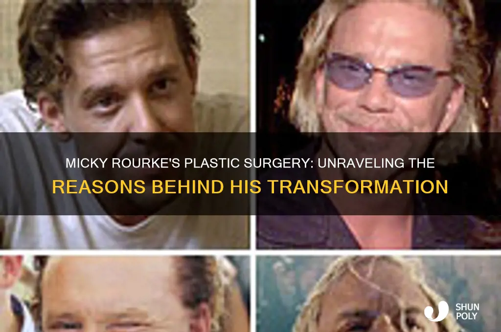 why did micky rourke have plastic surgery