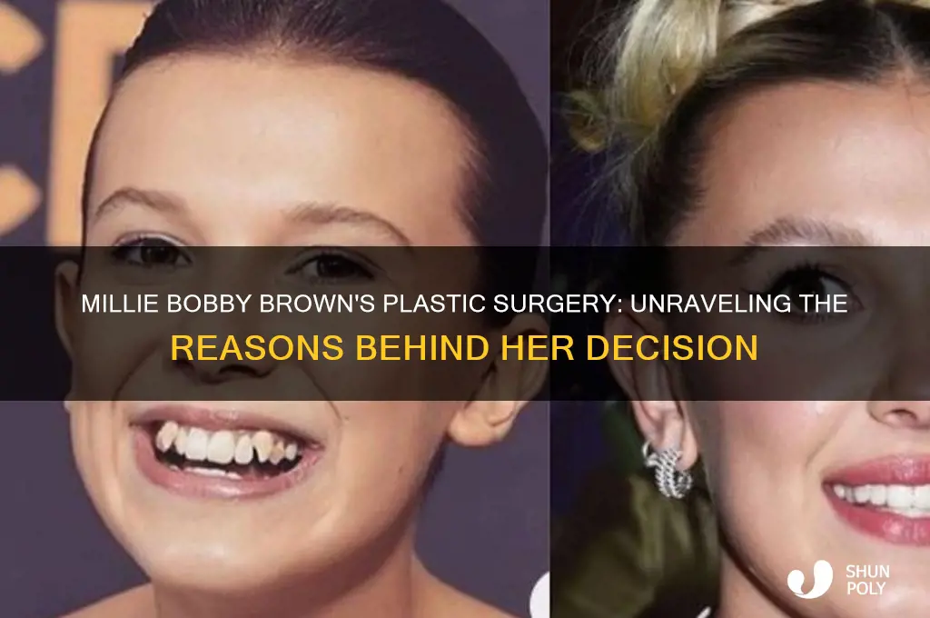 why did millie bobby brown get plastic surgery