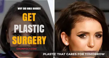 Nina Dobrev's Plastic Surgery: Unveiling the Truth Behind Her Transformation