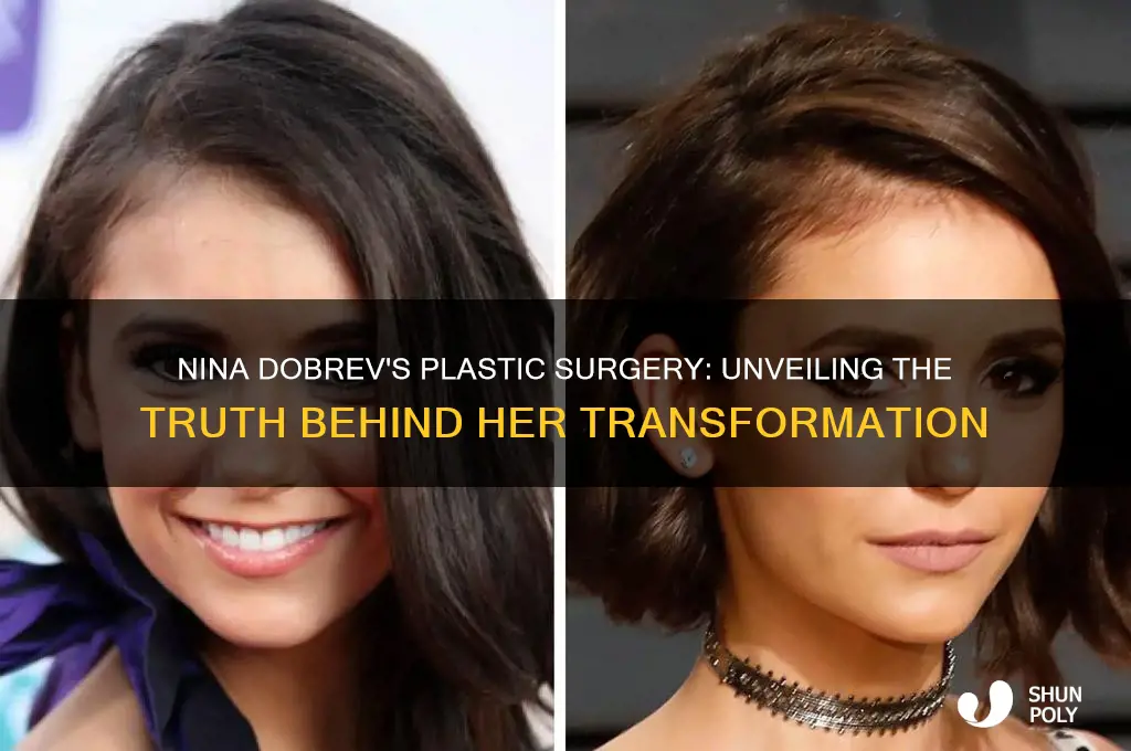 why did nina dobrev get plastic surgery