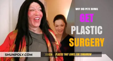 Pete Burns' Plastic Surgery Journey: Unraveling the Reasons Behind His Transformations