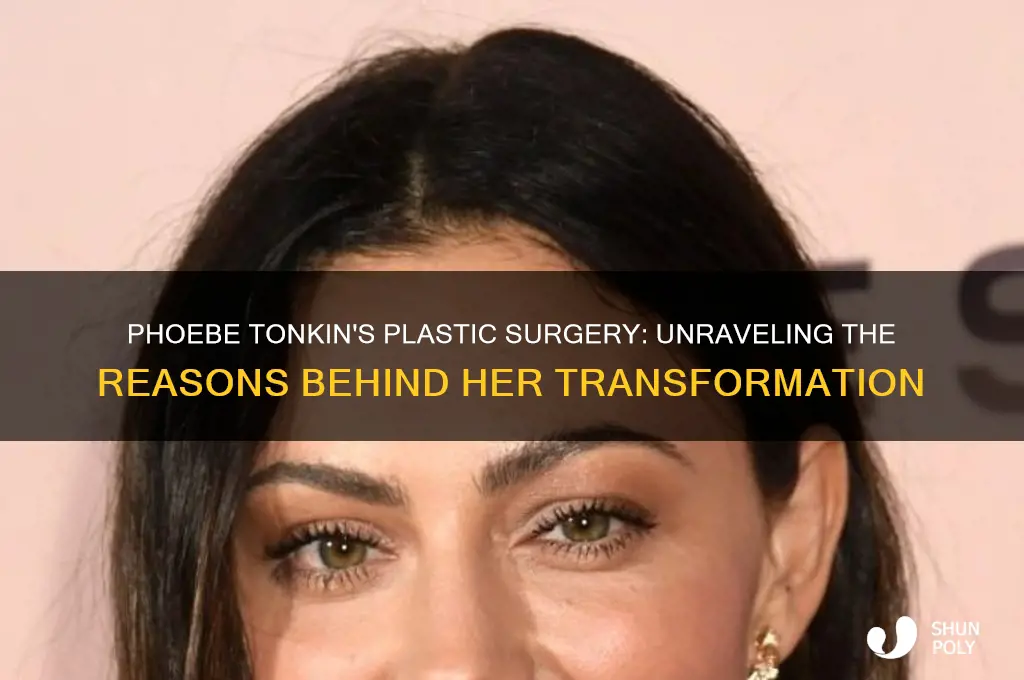 why did phoebe tonkin get plastic surgery
