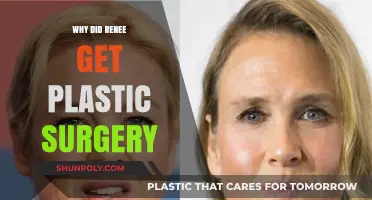 Renee's Transformation: Unveiling the Reasons Behind Her Plastic Surgery Decision