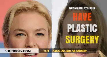 Renee Zellweger's Plastic Surgery: Unraveling the Reasons Behind Her Transformation
