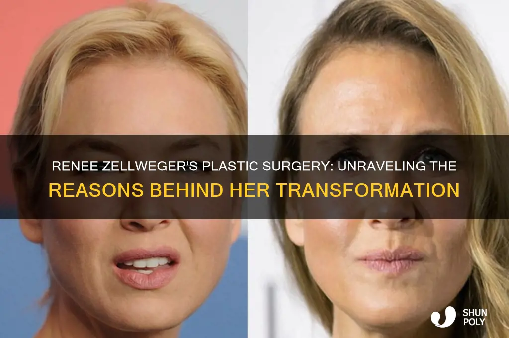 why did renee zelleger have plastic surgery