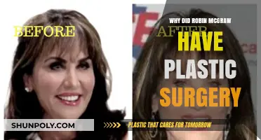 Robin McGraw's Plastic Surgery: Unveiling Her Transformation Journey and Reasons