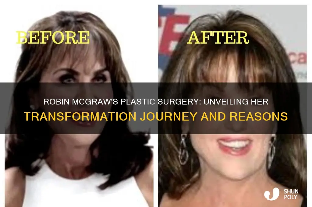 why did robin mcgraw have plastic surgery