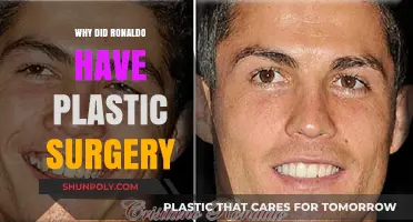 Cristiano Ronaldo's Plastic Surgery: Unraveling the Reasons Behind His Transformation